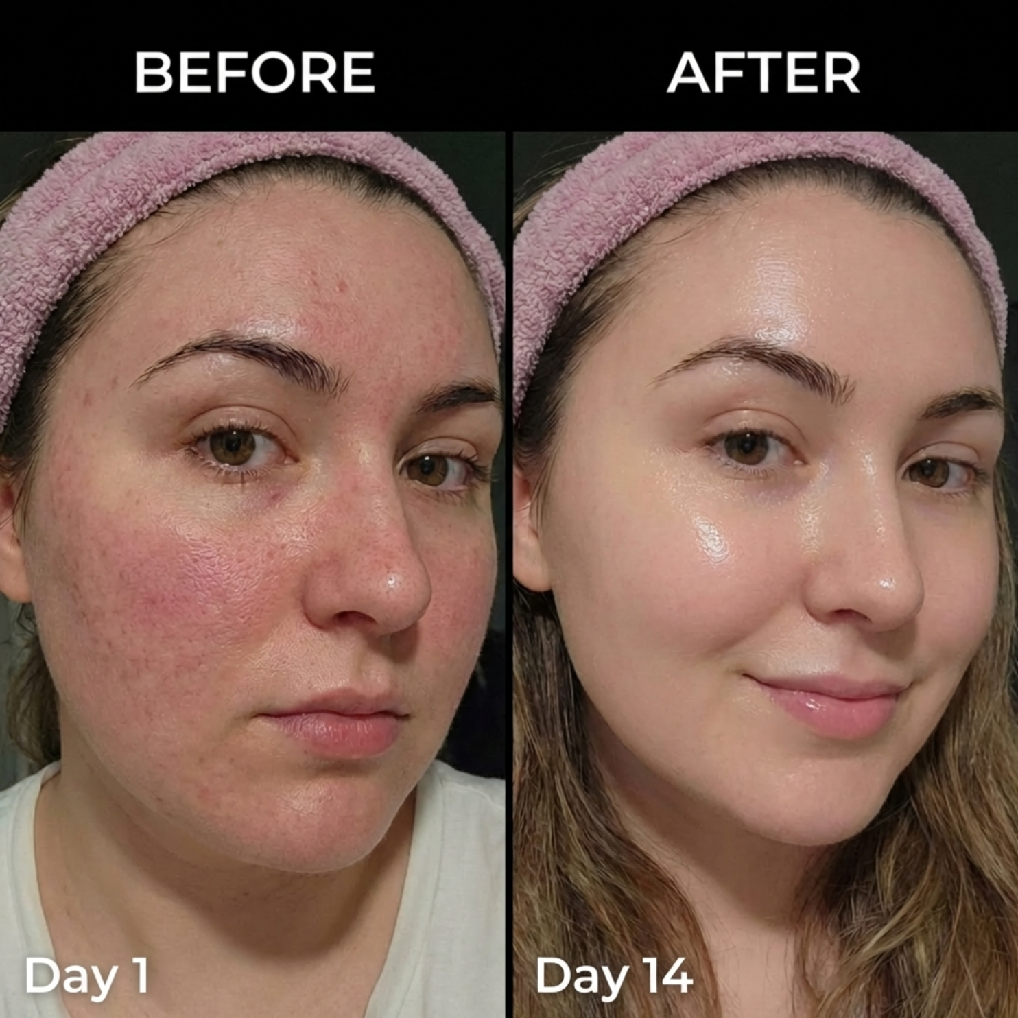 Medicube™ Multi Balm