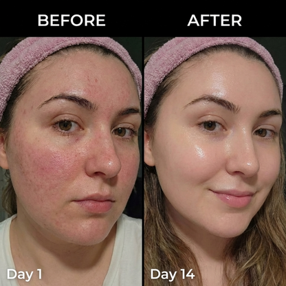 Medicube™ Multi Balm