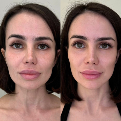 Medicube™ Collagen Glow Cream 100ml